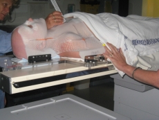 Preparing for radiation therapy